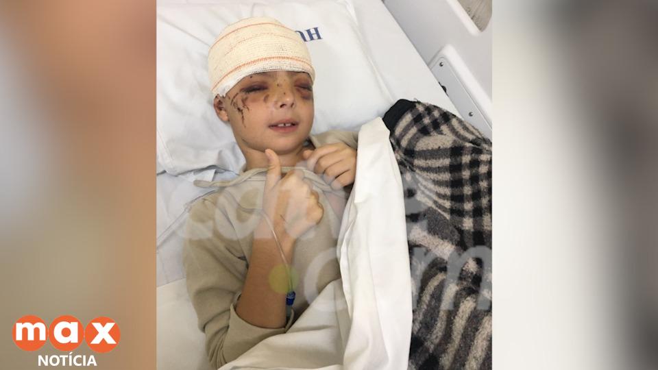 Menino atropelado dentro do condomínio de Cascavel recebe alta do hospital e já está em casa