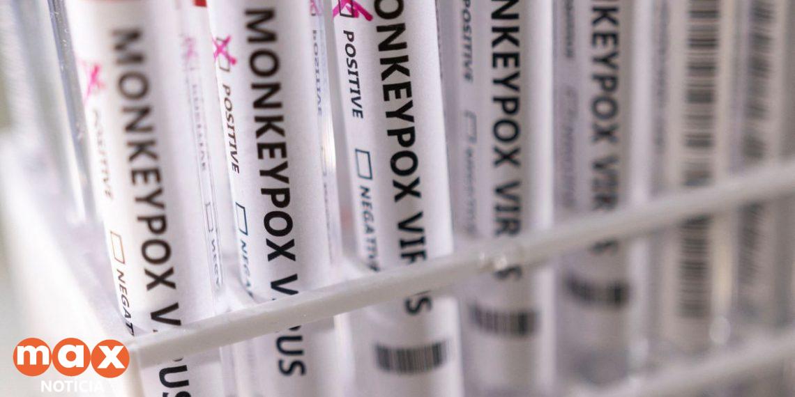 Três casos da varíola dos macacos estão sendo investigados em Foz