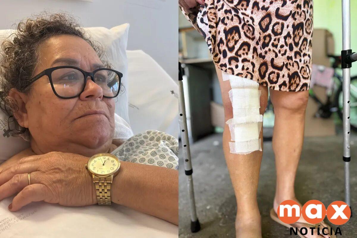 Idosa opera joelho errado e médico culpa paciente sedada no PR