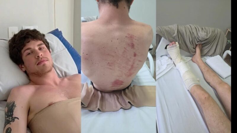 Jovem salva amiga de galho em praça e passa por cirurgia