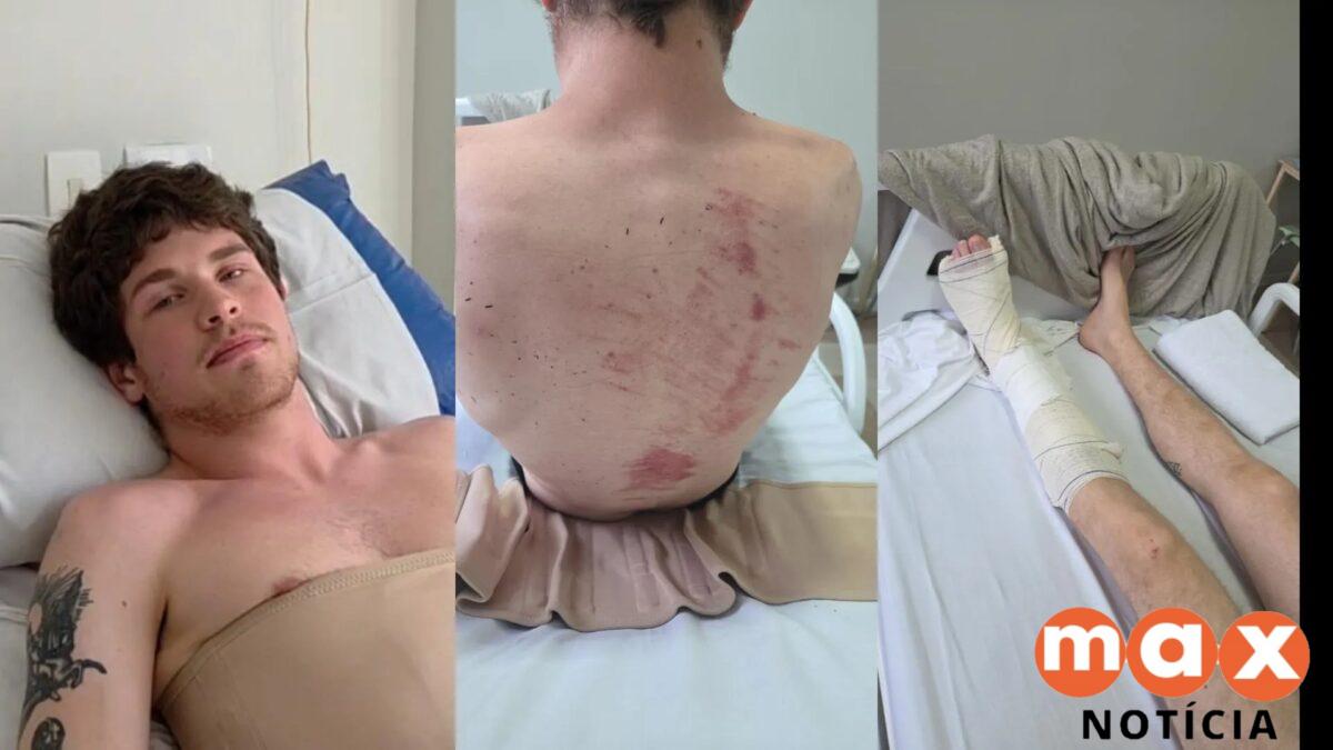 Jovem salva amiga de galho em praça e passa por cirurgia