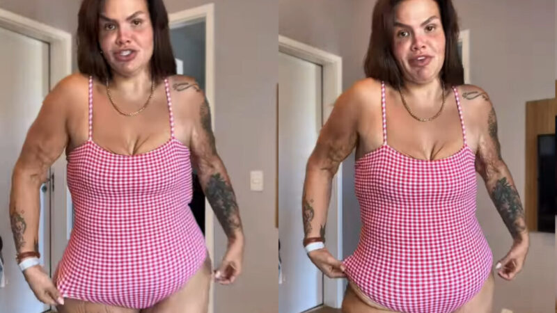 Thais Carla fala sobre excesso de pele após perder 120 kg
