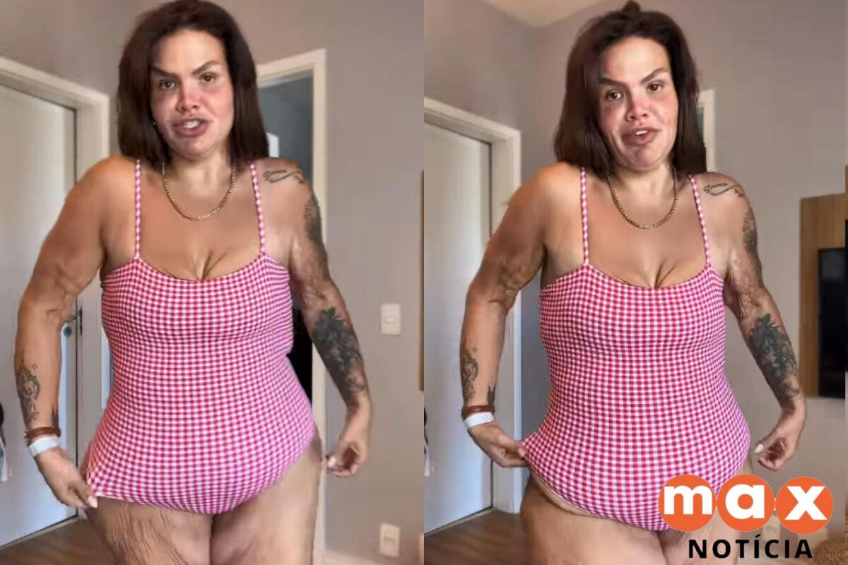 Thais Carla fala sobre excesso de pele após perder 120 kg